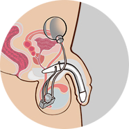 STEP 5 이미지