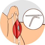 STEP 3 이미지